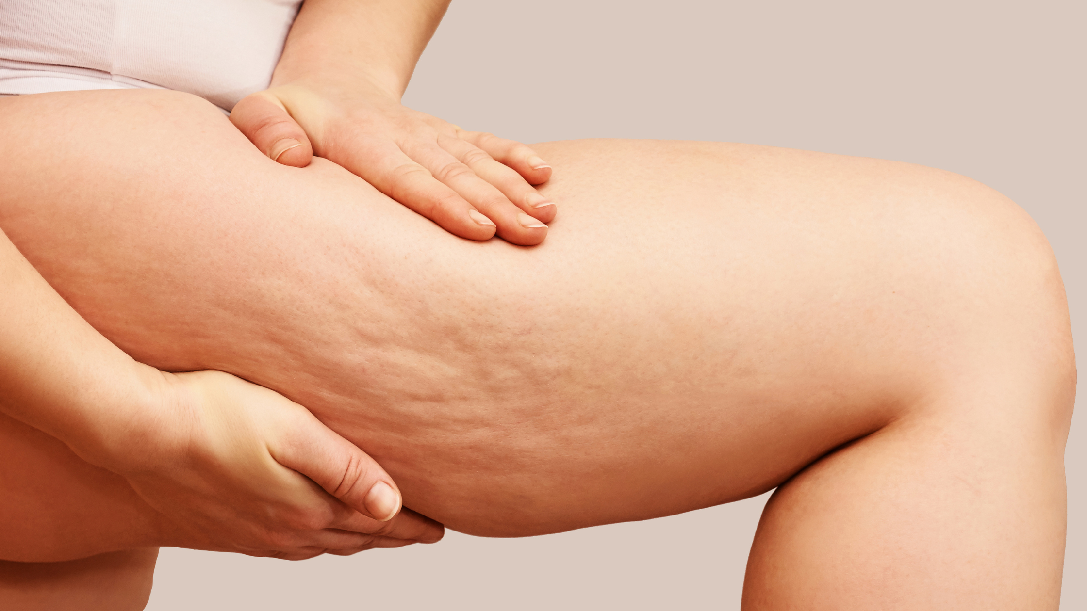 Can Balance MedSpa Help Me Reduce the Appearance of My Cellulite?