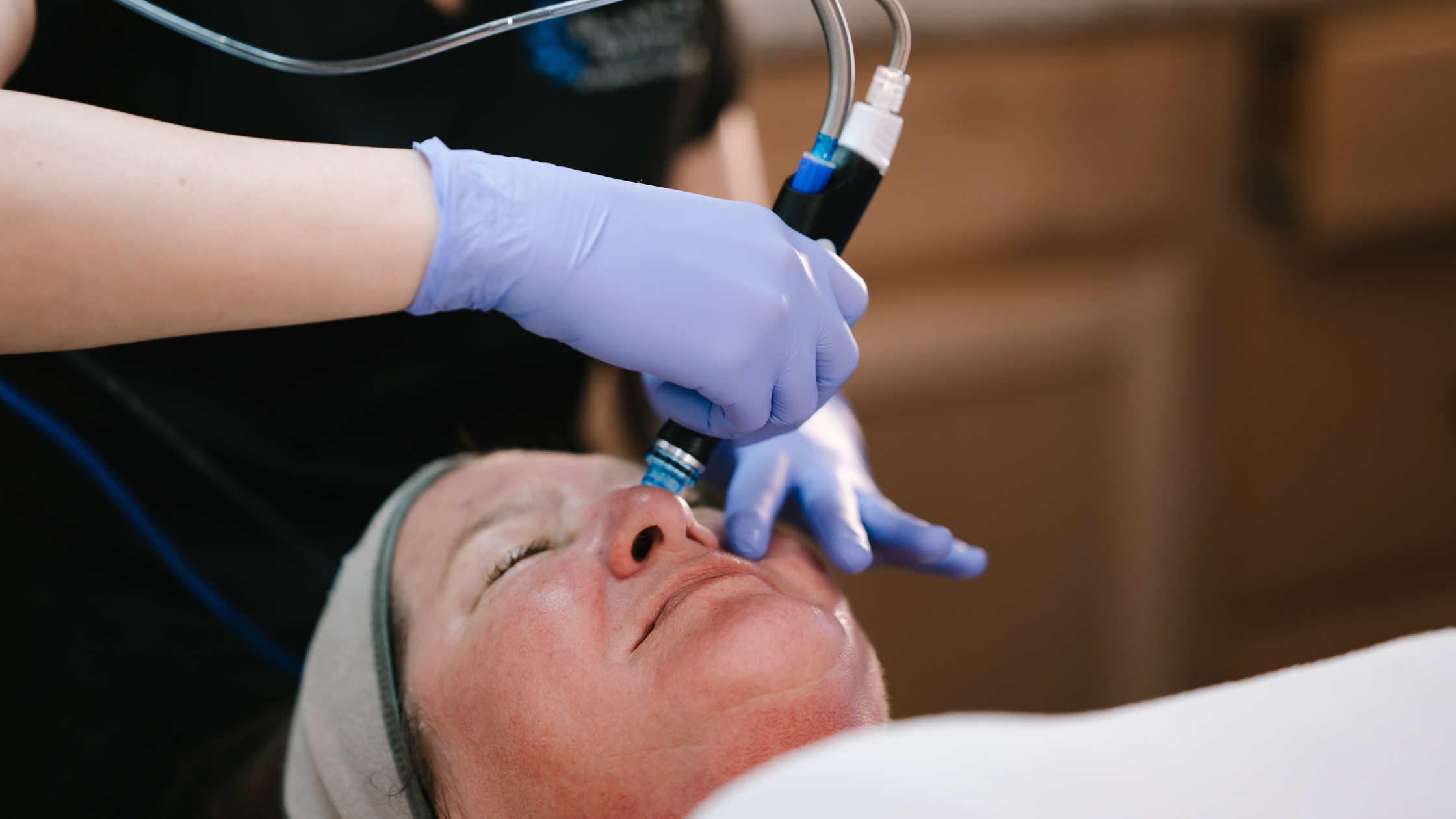 Can the HydraFacial Help Clear Up My Complexion?
